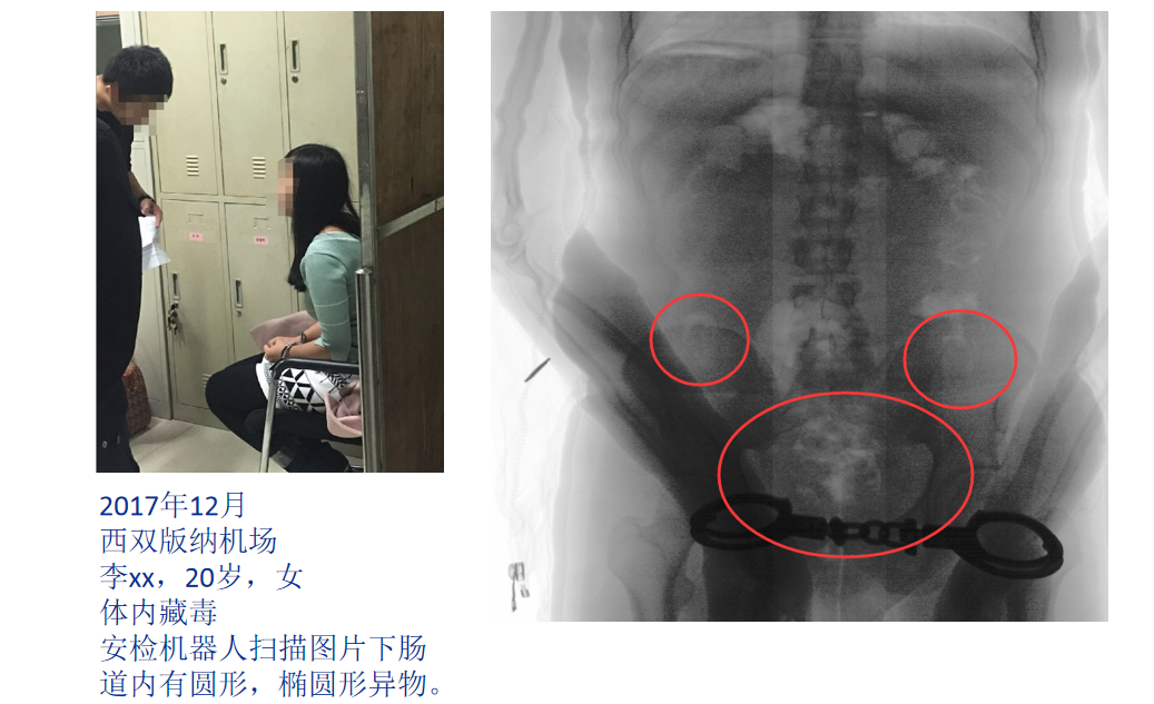 啟路達腹部檢測安檢機器人 4