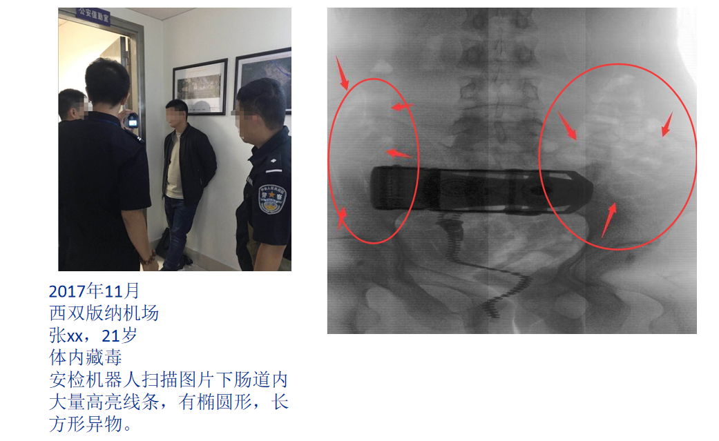 启路达腹部检测安检机器人 5