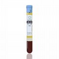 Prp Medical Blood Collection Tubes