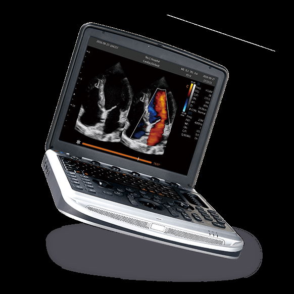 SonoBook 8,Portable Laptop Ultrasound Machine