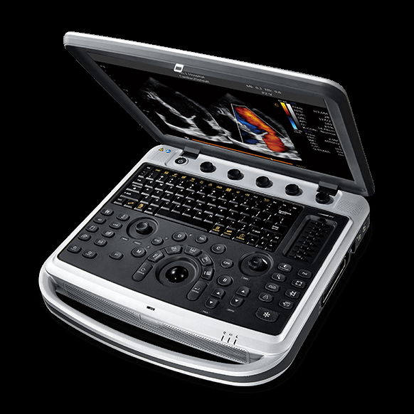 SonoBook 8,Portable Laptop Ultrasound Machine 3