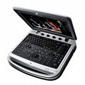 SonoBook 8,Portable Laptop Ultrasound Machine 3