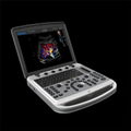 portable ultrasound machine for vascular access 1