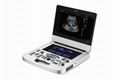 AX2 AX3 Portable Color Ultrasound 1