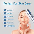 Kernel KN-4003BL vitiligo treatment device Skin Disorders Treated UVB Photothera 2