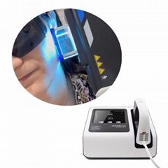 Kernel Factory Psoriasis laser 308nm Excimer laser vitiligo