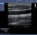 索诺星C5型彩色多普勒超声诊断系统便携式笔记本彩超 4