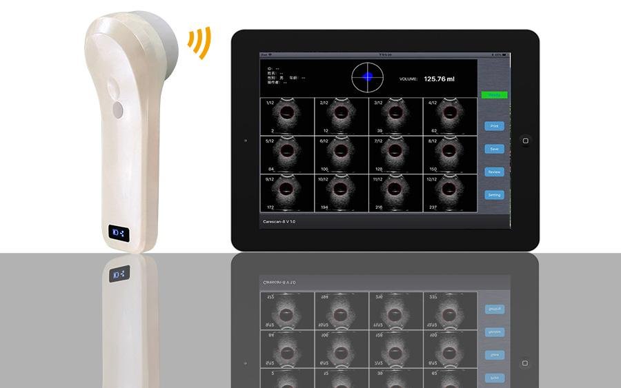   BProbe-2四維掃描無線探頭式膀胱儀 3