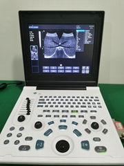 SS-6笔记本全数字超声诊断仪