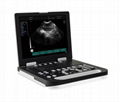 Ruisheng Ultrasound scanner