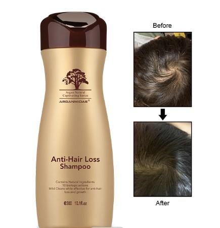 Hair Fall Treatment Shampoo|Hair Treatment For Hair Loss|Arganmidas