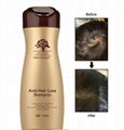 Hair Fall Treatment Shampoo|Hair Treatment For Hair Loss|Arganmidas 1