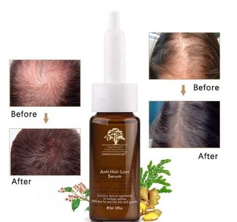Hair Fall Treatment|Hair Loss Treatment|Hair Oil Arganmidas