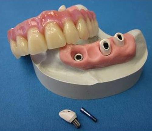 Dental lab Zirconia porcelain denture 2