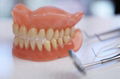 Customized CAD/Cam Vitallium Metal Cast Partial Dentures From China Dental Lab 1