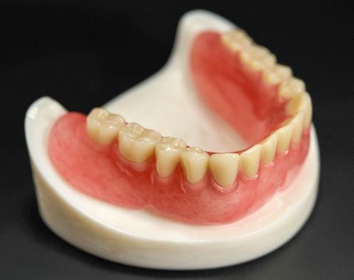 Customized CAD/Cam Vitallium Metal Cast Partial Dentures From China Dental Lab 2
