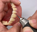 Customized CAD/Cam Vitallium Metal Cast Partial Dentures From China Dental Lab 3