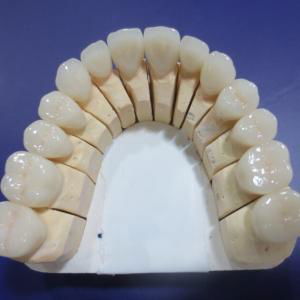 Factory Price Dental Cobalt Chrome Casting Framework Denture