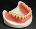 Factory Price Dental Cobalt Chrome Casting Framework Denture 2
