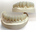 Braces For Overbite - Dental orthodontic braces 3