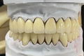 Zirconia Dental Crown | Zirconia Dental Lab in 2