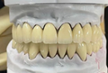 Zirconia Dental Crown | Zirconia Dental Lab in