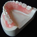 China Dental Lab Crowns & Dental Implant Crown