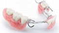 Porcelain-Fused-to-Metal (PFM) Crowns - China Dental Lab 1