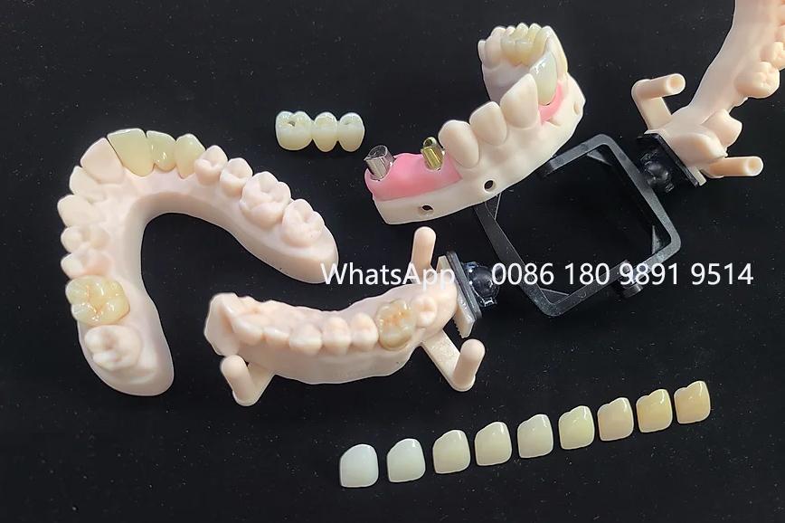 Dental Crown Lab China Clear Aligner Company