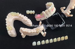 Dental Crown Lab China Clear Aligner