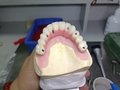  Dental-Implants MYY Dental Lab - Outsourcing China Dental Lab