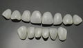 牙齒貼片國產玻璃陶瓷牙齒美白貼片仿真牙齒貼片可定製 2