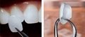 牙齒貼片可定製牙齒全瓷貼片鑄瓷仿真貼片 2