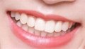 进口义获嘉蓝瓷可定制仿真牙齿超薄美白牙齿全瓷贴片 5