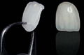 可定製牙齒全瓷貼片鑄瓷仿真牙齒貼片 1