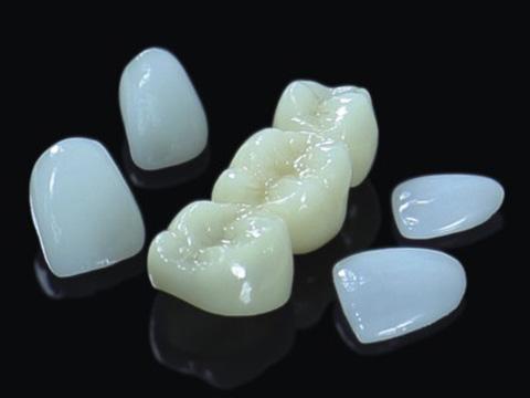 可定制牙齿全瓷贴片铸瓷仿真牙齿贴片 3