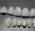 可定制牙齿全瓷贴片铸瓷仿真牙齿贴片 5