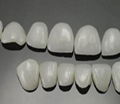 可定製牙齒全瓷貼片鑄瓷仿真牙齒貼片 5