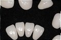 牙齒貼片國產愛爾創玻璃陶瓷牙齒超薄美白仿真牙齒貼片可定製 3