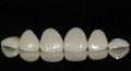 牙齒貼片牙齒美白貼片仿真牙齒貼片國產玻璃陶瓷可定製 1