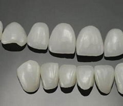 牙齒貼片可定製牙齒全瓷貼片國產鑄瓷仿真貼片