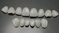 牙齿贴片可定制牙齿全瓷贴片国产铸瓷仿真贴片 5