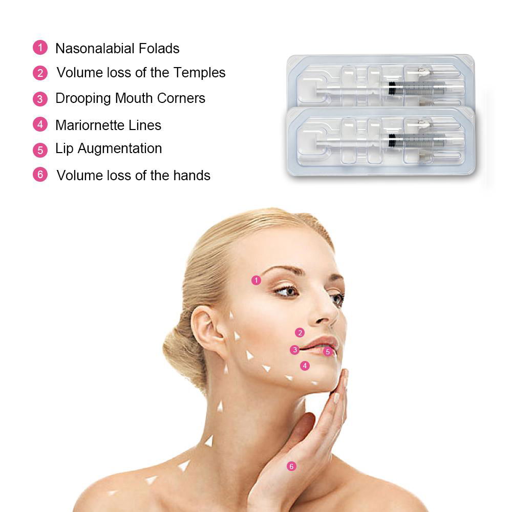 korean dermal filler face effective lifting hyaluronic acidcross linke 4