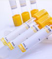 Gel&Clot Activator Tubes Evacuated Blood Collection Serum Tube, Test Tube for Bl