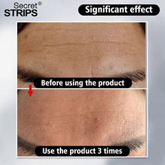 Anti wrinkle forehead patch 