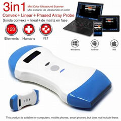 SonoStar 128 Elements Wireless Color Ultrasound Convex