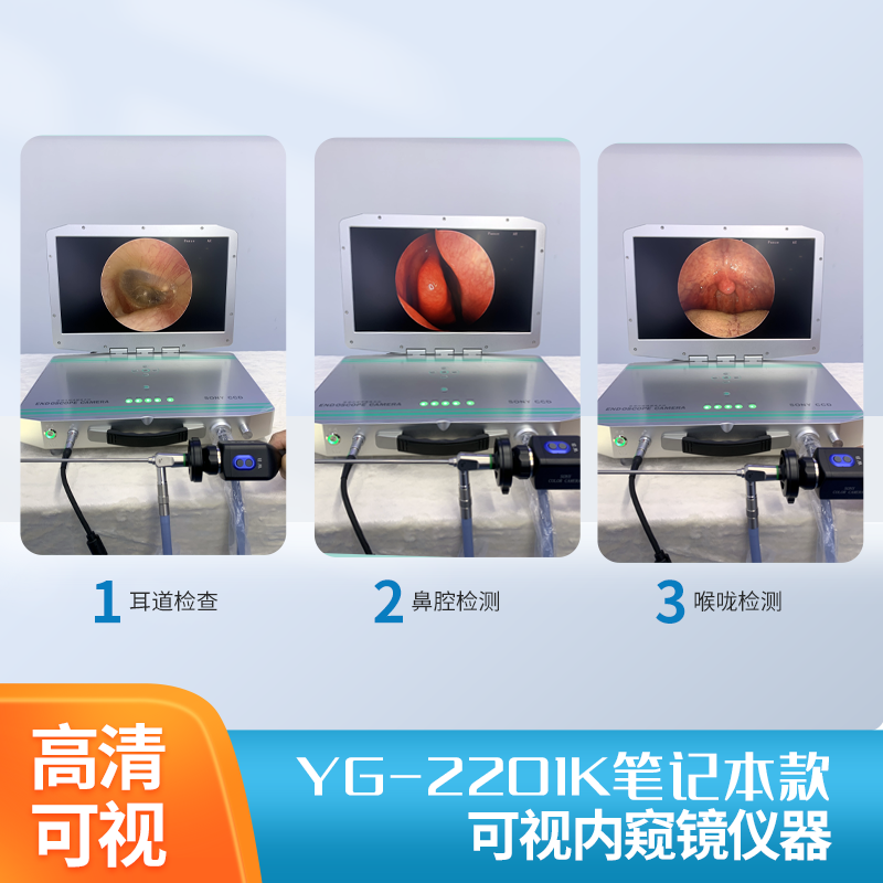 笔记本款可携带内窥镜摄像系统 YG-2201K 2