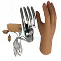 Prosthetics Upper Limbs Myoelectric