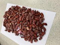 IQF red kidney beans,Frozen Red Kidney Bean,cooked,ready to eat 11