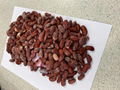 IQF Mixed Kidney Beans,Frozen Mixed Kidney Beans,cooked,ready to eat